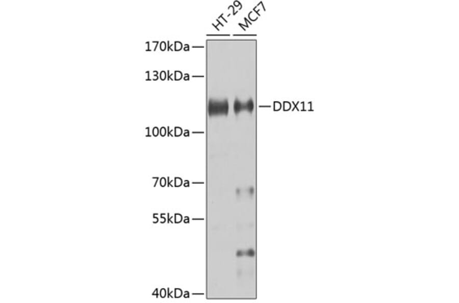 Western Blot - Anti-DDX11 Antibody (A10187) - Antibodies.com