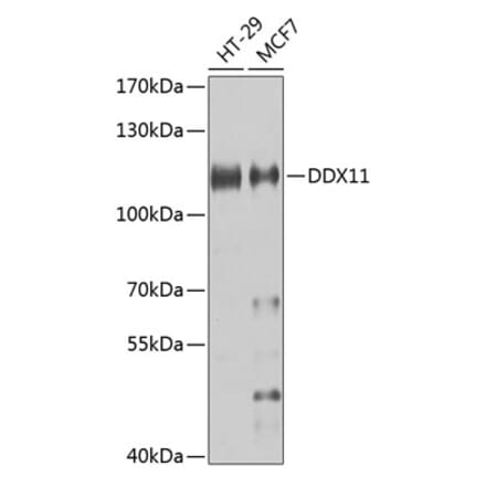 Western Blot - Anti-DDX11 Antibody (A10187) - Antibodies.com