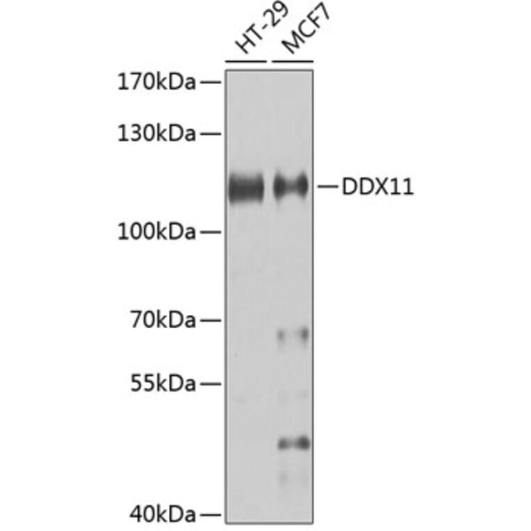 Western Blot - Anti-DDX11 Antibody (A10187) - Antibodies.com