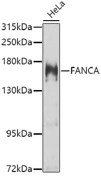 Western blot analysis of extracts of HeLa cells, using Anti-FANCA Antibody (A7671) at 1:1,000 dilution.
Secondary antibody: Goat Anti-Rabbit IgG (H+L) (HRP) (AS014) at 1:10,000 dilution.
Lysates / proteins: 25µg per lane.
Blocking buffer: 3% non-fat dry milk in TBST.
Detection: ECL Basic Kit (RM00020).
Exposure time: 30s.