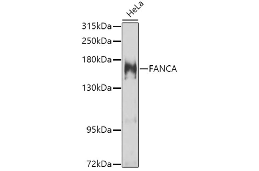 Western Blot - Anti-FANCA/FAA Antibody (A10188) - Antibodies.com