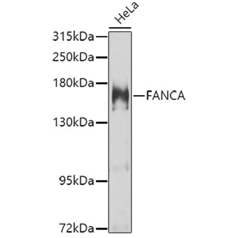 Western Blot - Anti-FANCA/FAA Antibody (A10188) - Antibodies.com