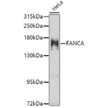 Western Blot - Anti-FANCA/FAA Antibody (A10188) - Antibodies.com