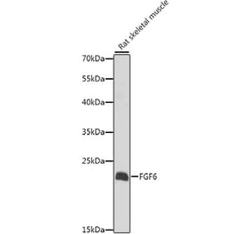 Western Blot - Anti-FGF6 Antibody (A10189) - Antibodies.com