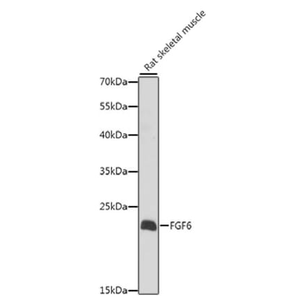 Western Blot - Anti-FGF6 Antibody (A10189) - Antibodies.com