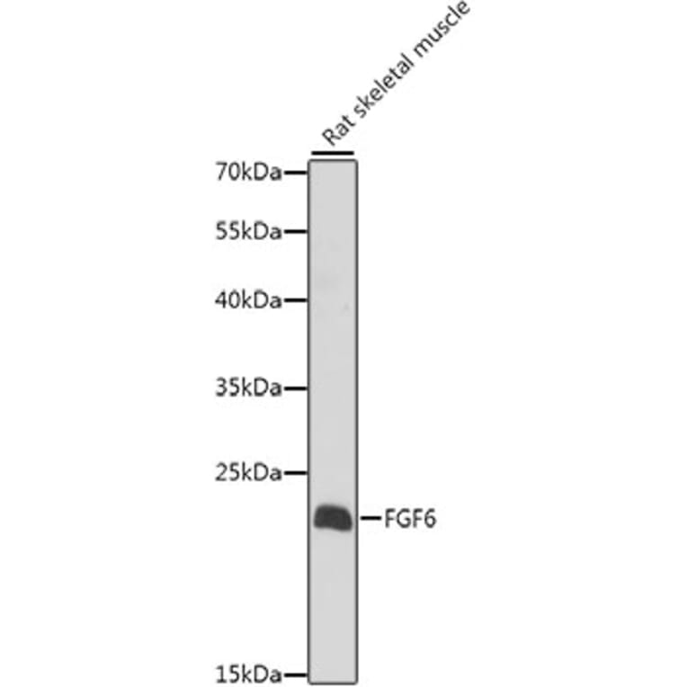 Western Blot - Anti-FGF6 Antibody (A10189) - Antibodies.com