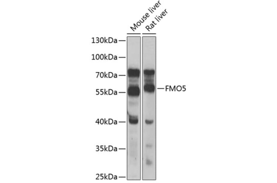Western Blot - Anti-FMO5 Antibody (A10190) - Antibodies.com