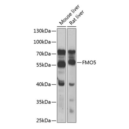 Western Blot - Anti-FMO5 Antibody (A10190) - Antibodies.com
