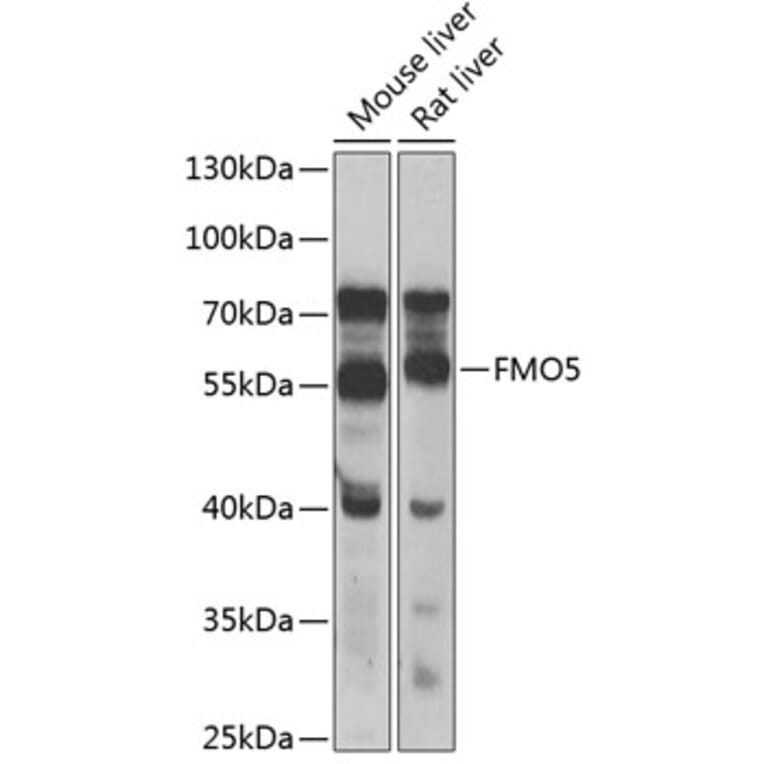 Western Blot - Anti-FMO5 Antibody (A10190) - Antibodies.com