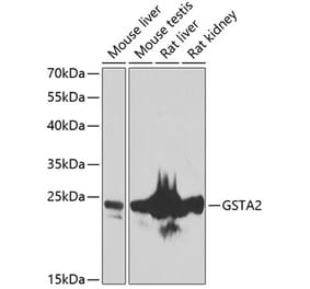 Western Blot - Anti-GSTA2 Antibody (A10192) - Antibodies.com