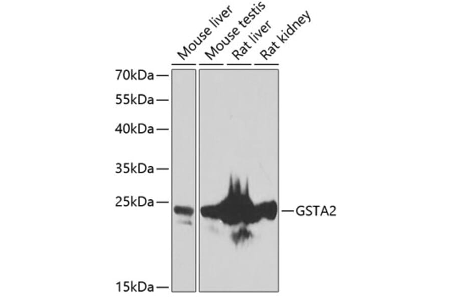 Western Blot - Anti-GSTA2 Antibody (A10192) - Antibodies.com