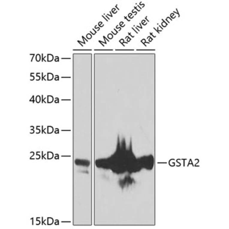 Western Blot - Anti-GSTA2 Antibody (A10192) - Antibodies.com