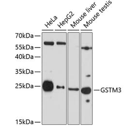 Western Blot - Anti-GSTM3 Antibody (A10193) - Antibodies.com