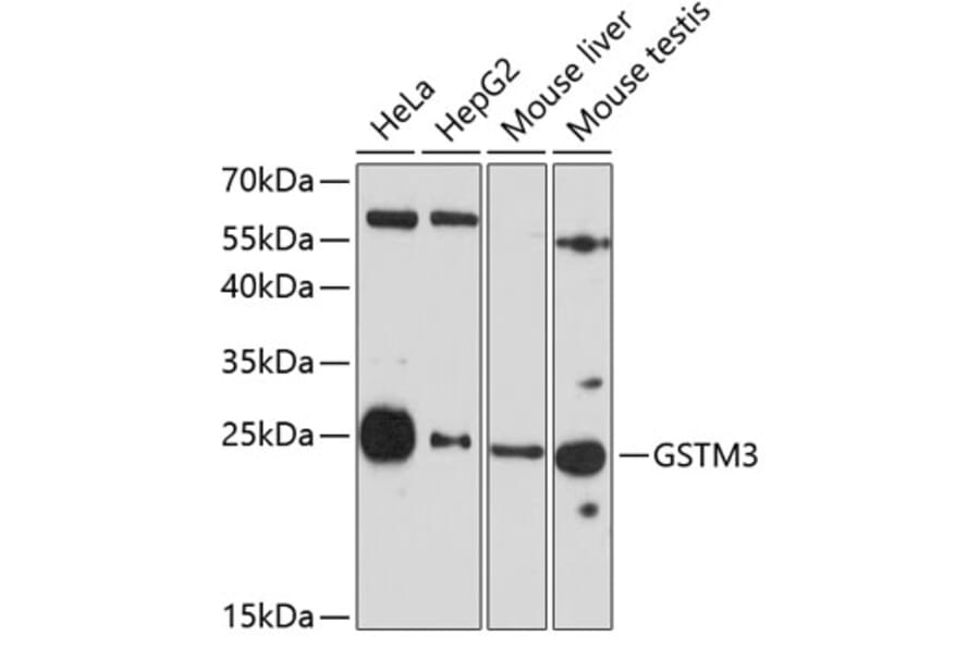 Western Blot - Anti-GSTM3 Antibody (A10193) - Antibodies.com