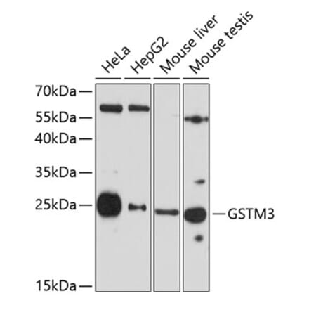 Western Blot - Anti-GSTM3 Antibody (A10193) - Antibodies.com