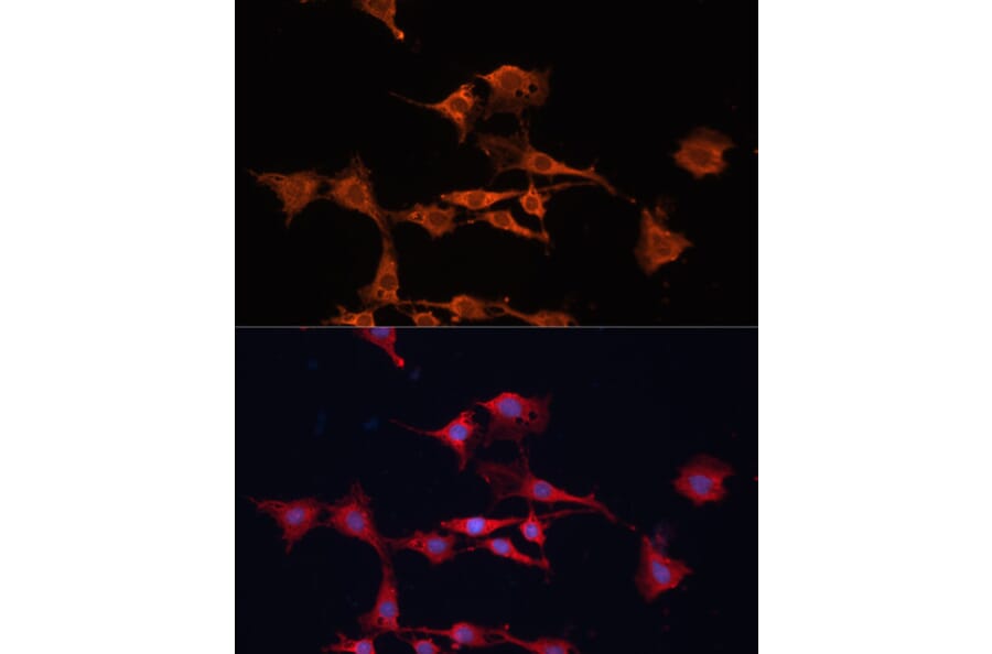 Immunofluorescence - Anti-GSTM3 Antibody (A10193) - Antibodies.com
