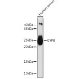 Western Blot - Anti-GYPB/GPB Antibody (A10194) - Antibodies.com