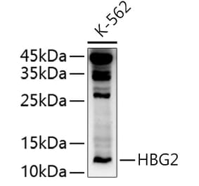 Western Blot - Anti-fetal hemoglobin Antibody (A10195) - Antibodies.com