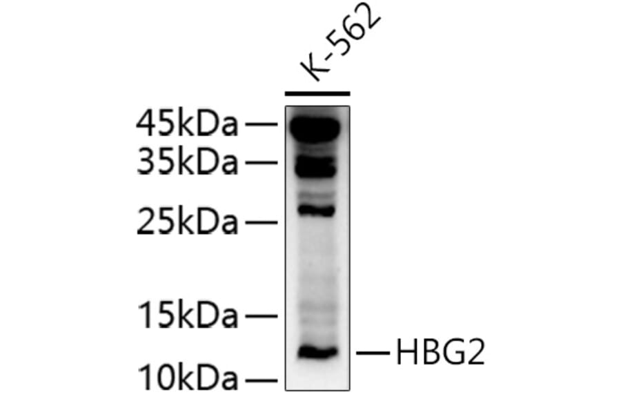 Western Blot - Anti-Fetal Hemoglobin Antibody (A10195) - Antibodies.com