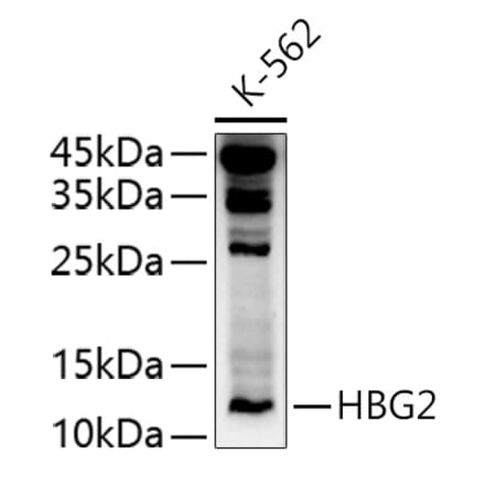 Western Blot - Anti-Fetal Hemoglobin Antibody (A10195) - Antibodies.com