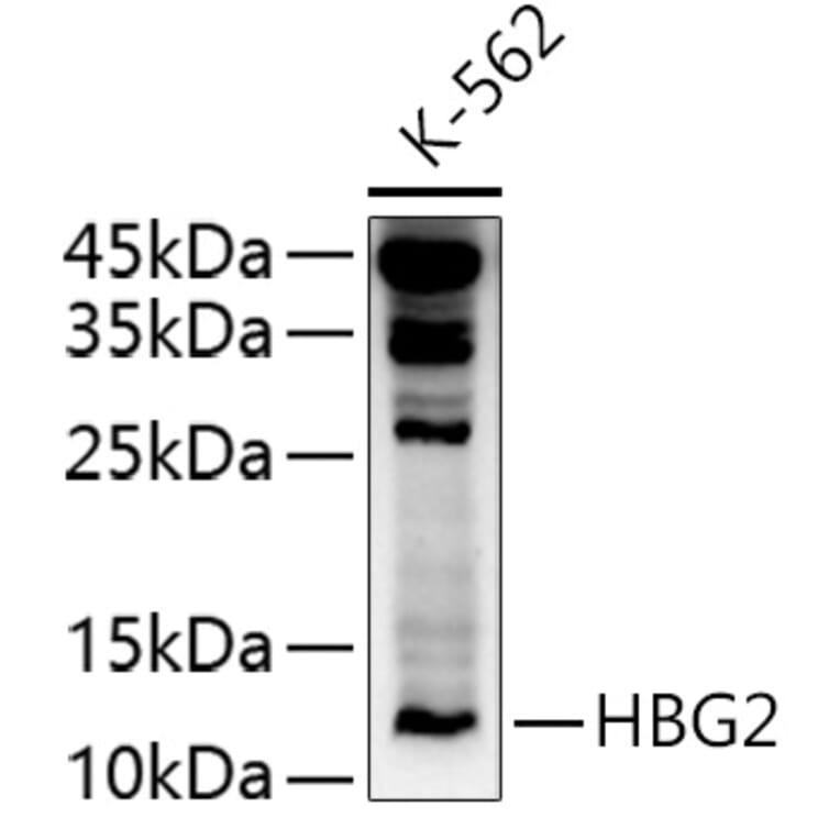 Western Blot - Anti-fetal hemoglobin Antibody (A10195) - Antibodies.com