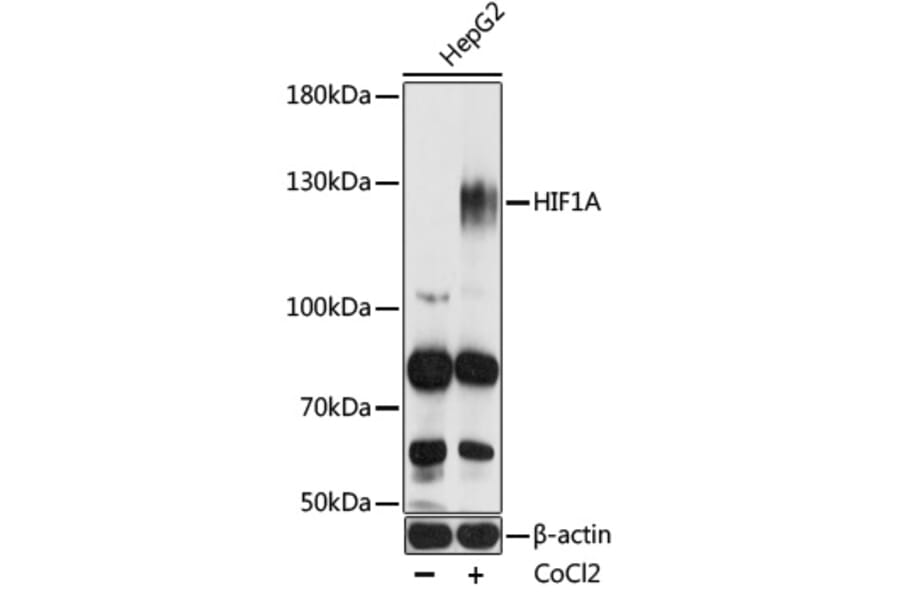 Western Blot - Anti-HIF1A Antibody (A7684) - Antibodies.com