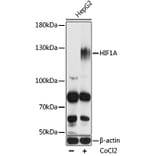 Western Blot - Anti-HIF1A Antibody (A7684) - Antibodies.com