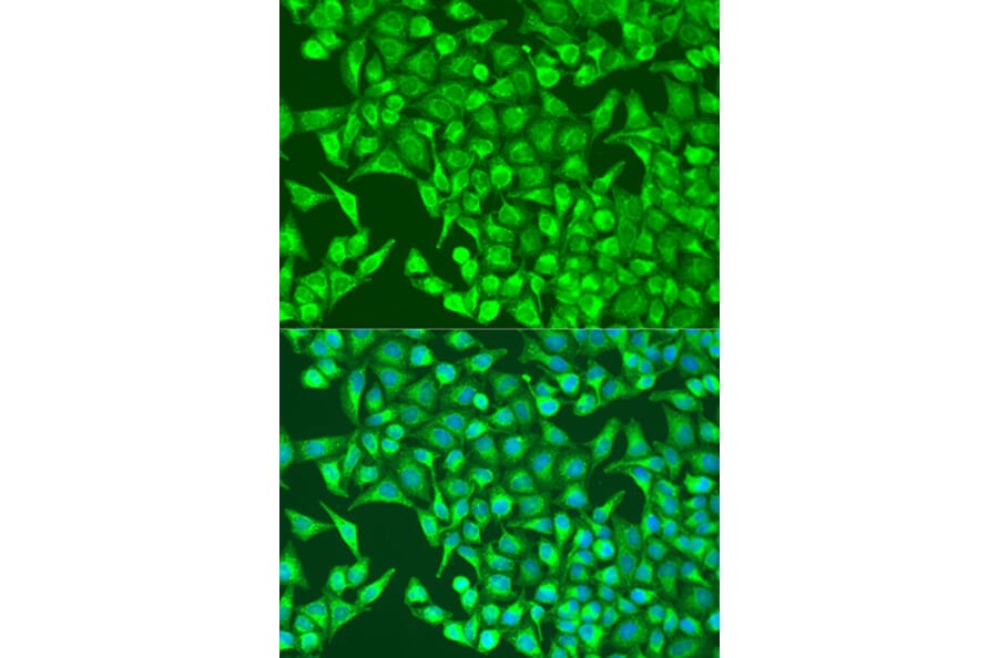 Immunofluorescence - Anti-HIF1A Antibody (A7684) - Antibodies.com