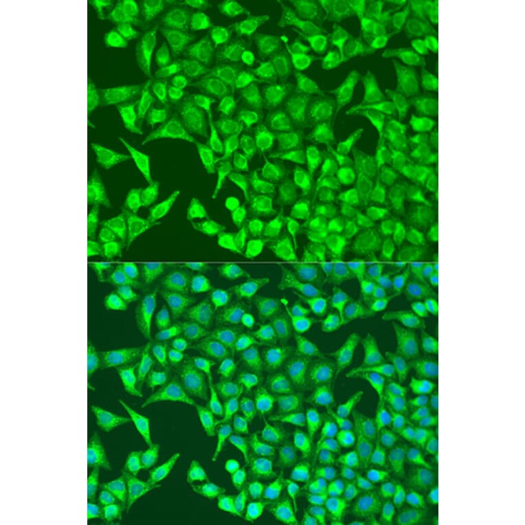 Immunofluorescence - Anti-HIF1A Antibody (A7684) - Antibodies.com
