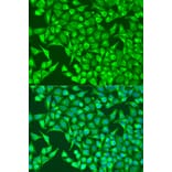 Immunofluorescence - Anti-HIF1A Antibody (A7684) - Antibodies.com