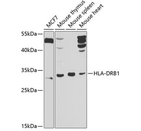 Western Blot - Anti-HLA Class II DRB1 Antibody (A10197) - Antibodies.com