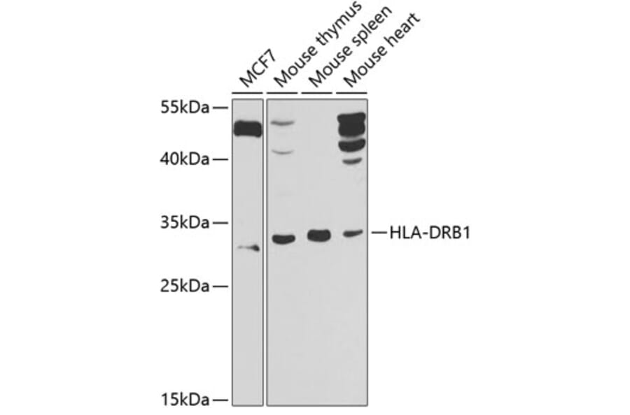 Western Blot - Anti-HLA Class II DRB1 Antibody (A10197) - Antibodies.com