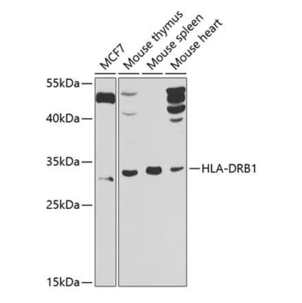 Western Blot - Anti-HLA Class II DRB1 Antibody (A10197) - Antibodies.com