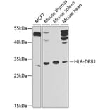 Western Blot - Anti-HLA Class II DRB1 Antibody (A10197) - Antibodies.com