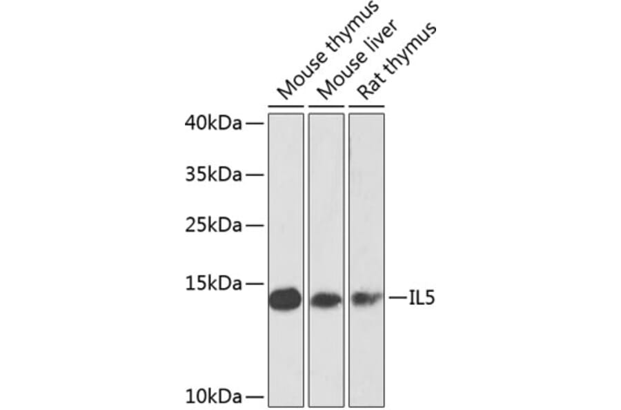Western Blot - Anti-IL-5 Antibody (A10200) - Antibodies.com