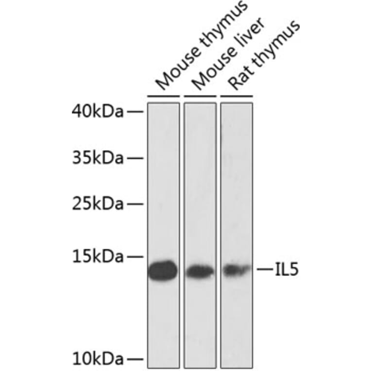 Western Blot - Anti-IL-5 Antibody (A10200) - Antibodies.com