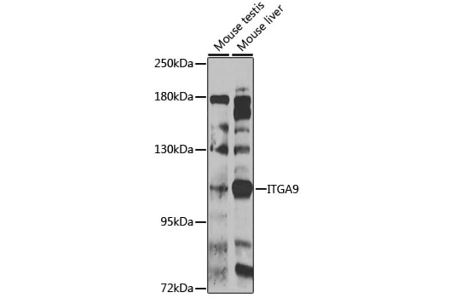 Western Blot - Anti-Integrin alpha 9 Antibody (A10201) - Antibodies.com