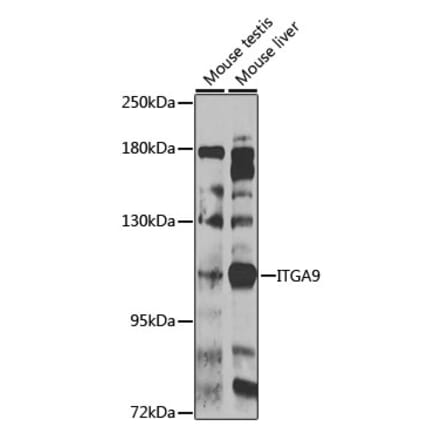 Western Blot - Anti-Integrin alpha 9 Antibody (A10201) - Antibodies.com