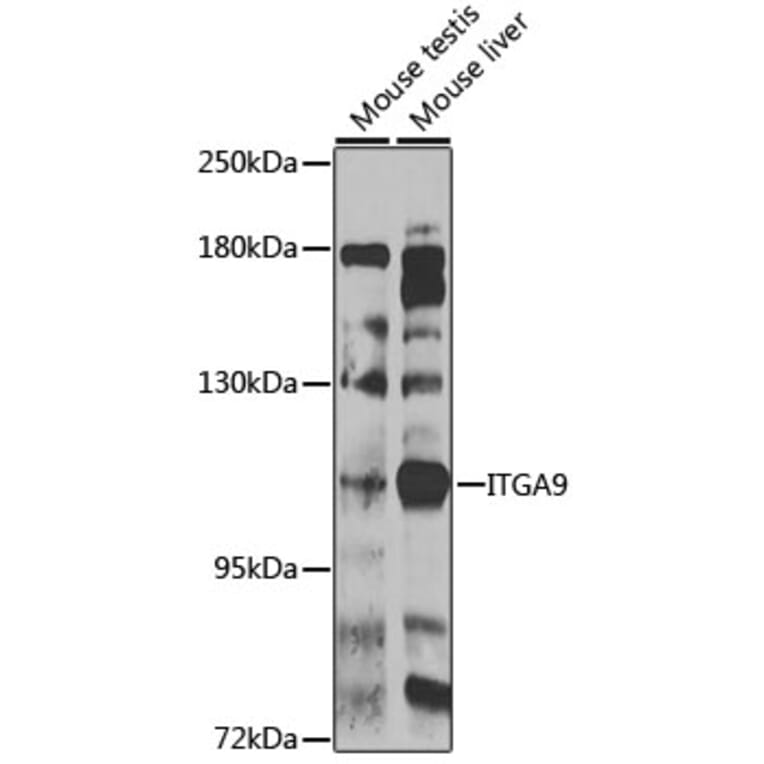 Western Blot - Anti-Integrin alpha 9 Antibody (A10201) - Antibodies.com