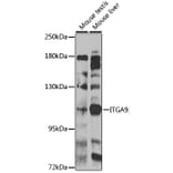 Western Blot - Anti-Integrin alpha 9 Antibody (A10201) - Antibodies.com