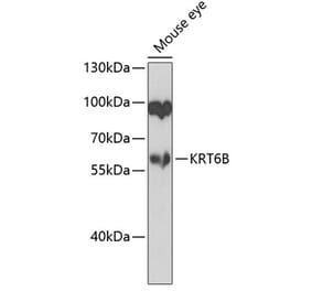 Western Blot - Anti-Cytokeratin 6b Antibody (A10202) - Antibodies.com