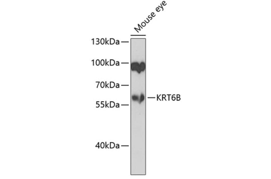 Western Blot - Anti-Cytokeratin 6b Antibody (A10202) - Antibodies.com