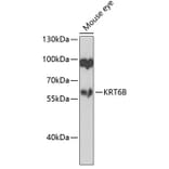 Western Blot - Anti-Cytokeratin 6b Antibody (A10202) - Antibodies.com