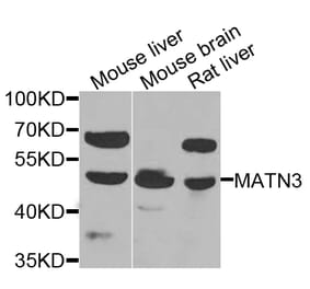 Western Blot - Anti-MATN3 Antibody (A7700) - Antibodies.com