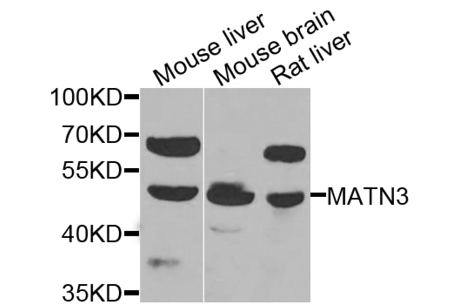 Western Blot - Anti-MATN3 Antibody (A7700) - Antibodies.com