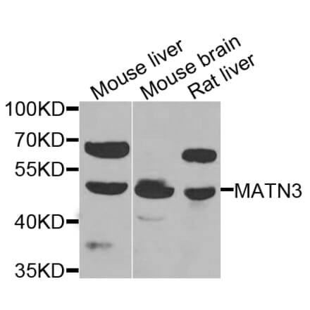 Western Blot - Anti-MATN3 Antibody (A7700) - Antibodies.com