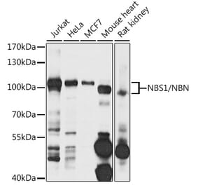 Western Blot - Anti-NBS1 Antibody (A10204) - Antibodies.com