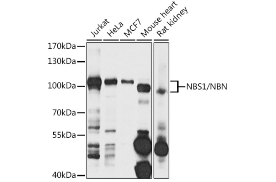 Western Blot - Anti-NBS1 Antibody (A10204) - Antibodies.com