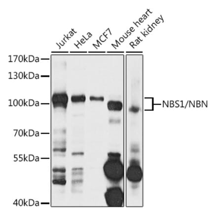 Western Blot - Anti-NBS1 Antibody (A10204) - Antibodies.com