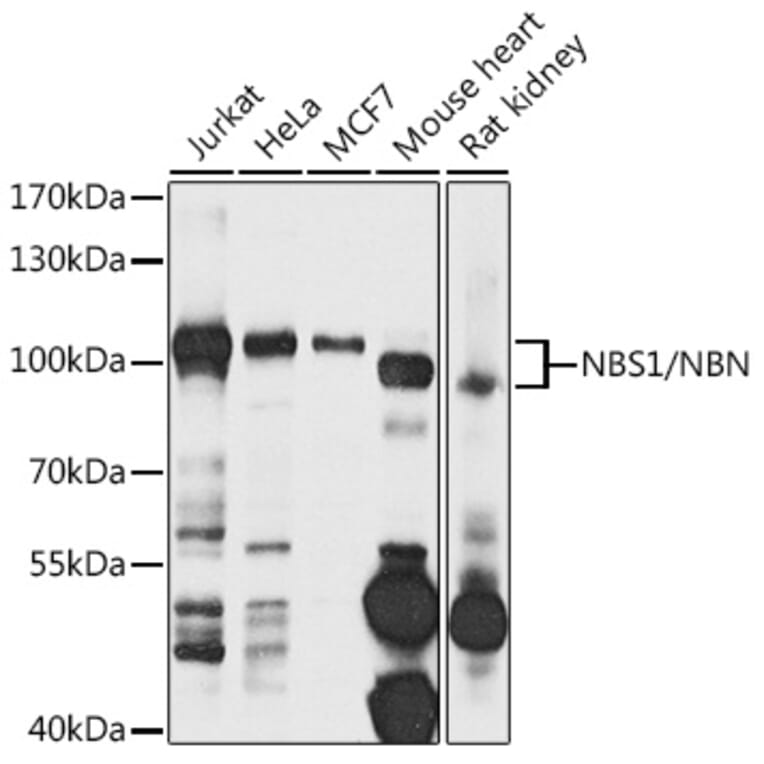 Western Blot - Anti-NBS1 Antibody (A10204) - Antibodies.com